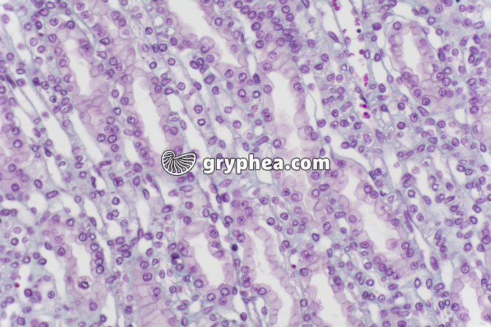 Rein tubules urinaires CL x100 - gryphea.com